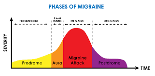 Stages of Migraine 